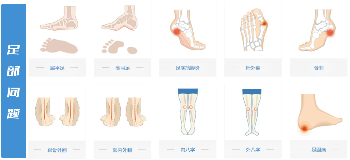 1200x720-错误步态影响--足部问题.jpg
